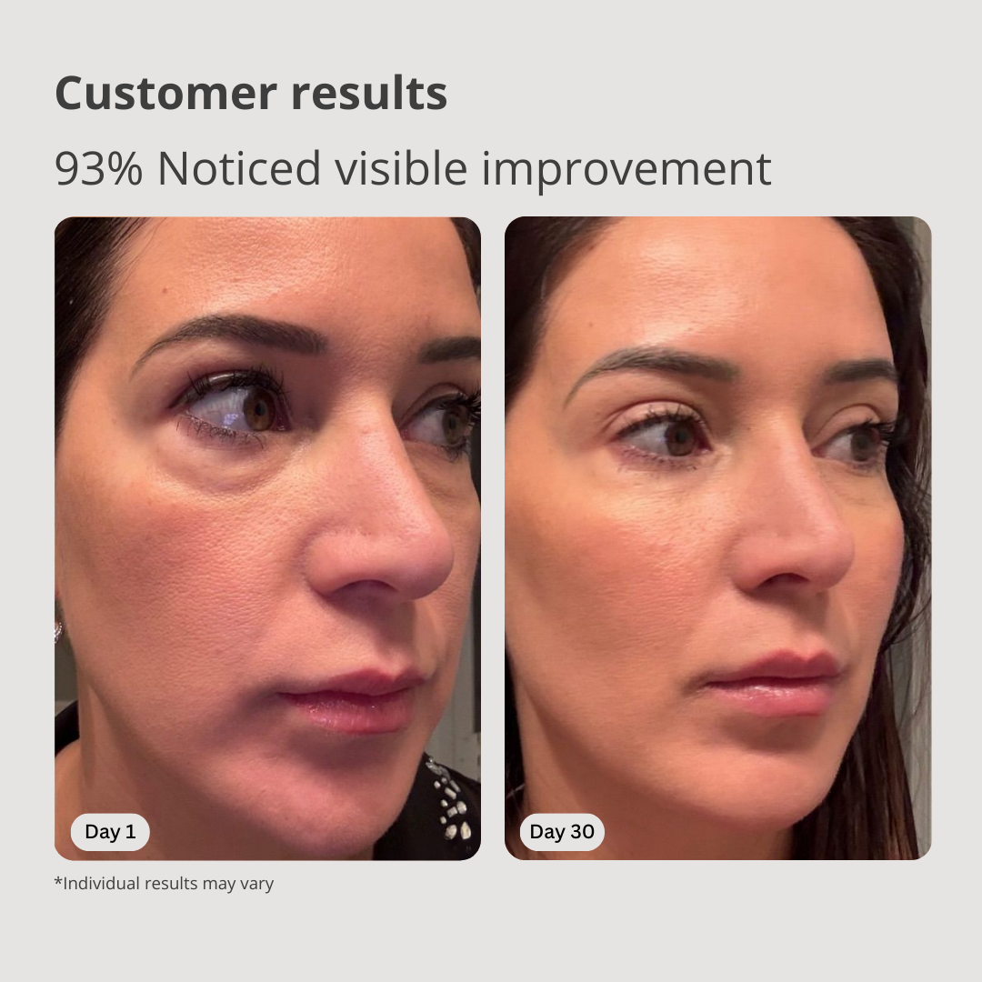 Skincare Massager
